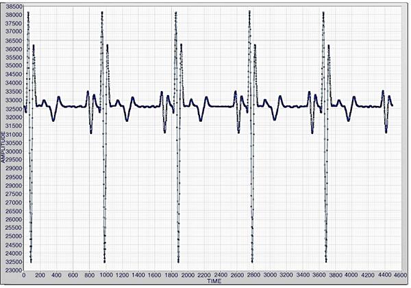 Image of ECG generator set at 60 BPM