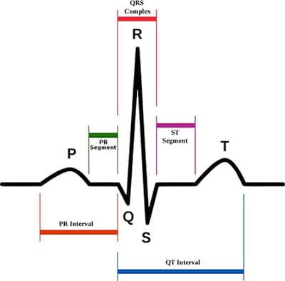 Graph of ECGs provide extensive information about cardiac health