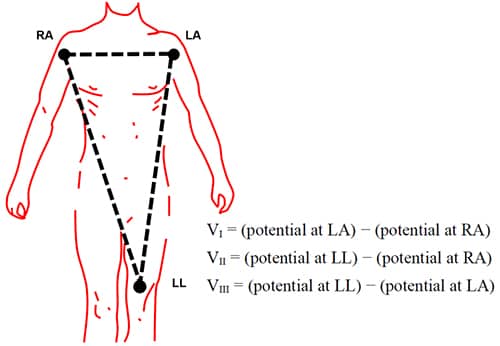 ECG 信号可以在身体上的很多部位检测到示意图