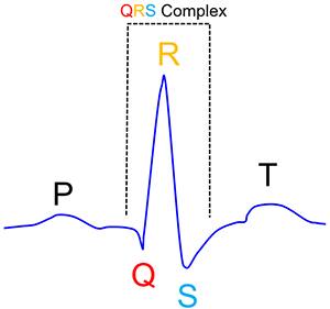 Q、R、S 点产生 QRS 波群示意图
